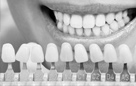 Leistungen aus dem Bereich der restaurativen Zahnheilkunde